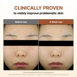 Mandelic Acid Gentle Exfoliating Toner 30ml -Wishtrend Comestics Store MandelicAcidGentleExfoliatingToner thumbnail 03 info6 1