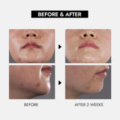 Maskne Repair Box -Wishtrend Comestics Store Maskne Repair Box thumbnail 03 info2