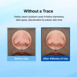 Midnight Blue Clearing Water Cream -Wishtrend Comestics Store Midnight Blue Clearing Water Cream PDP 05