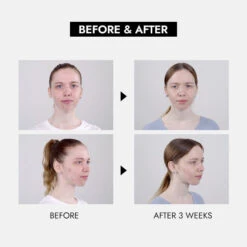 Step By Step Acne Self Care Box -Wishtrend Comestics Store Step by Step Acne Self Care Box thumbnail 03 info2