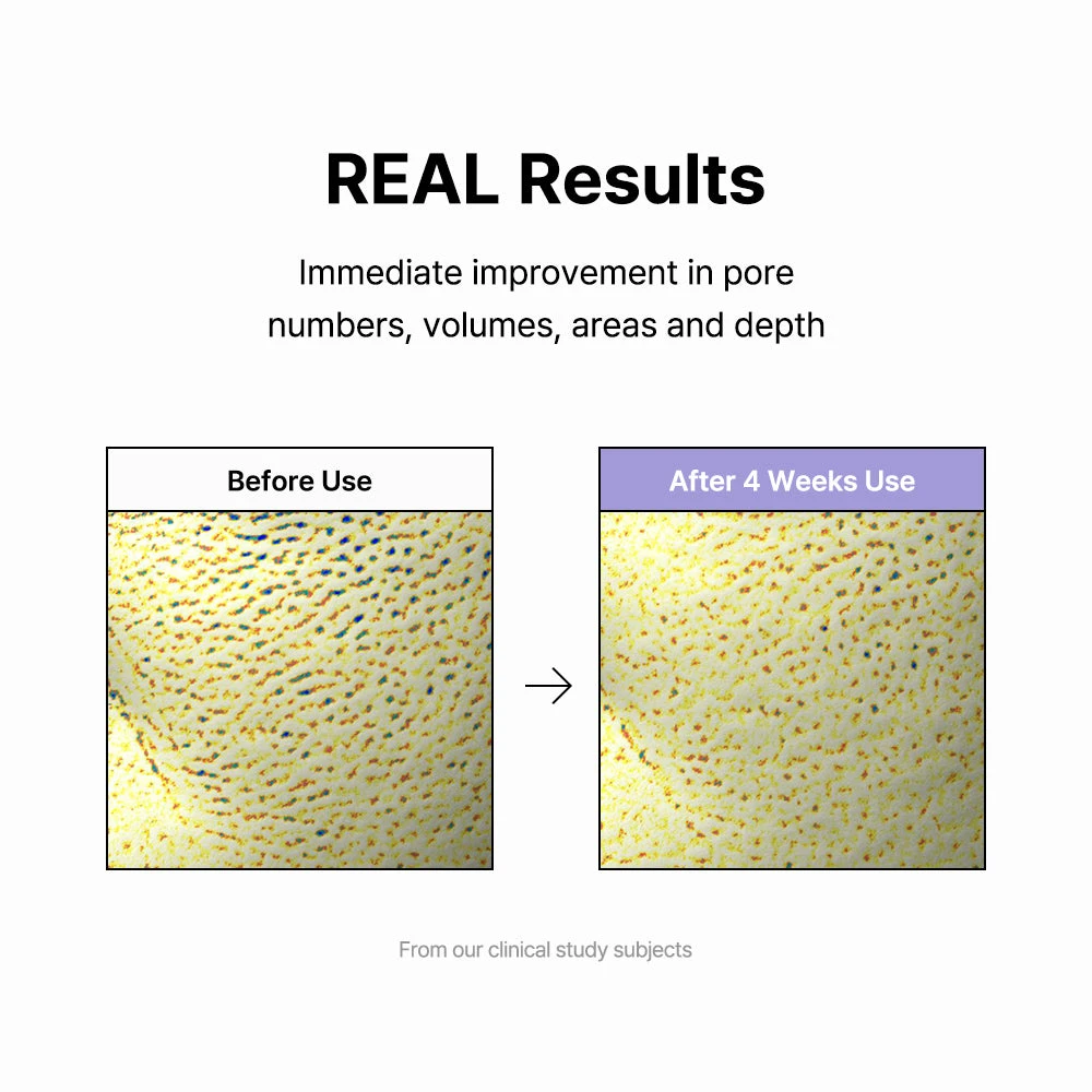 Vitamin A Mazing Bakuchiol Night Cream 10ml 14 Vitamin A Mazing Bakuchiol Night Cream 10ml - Image 14